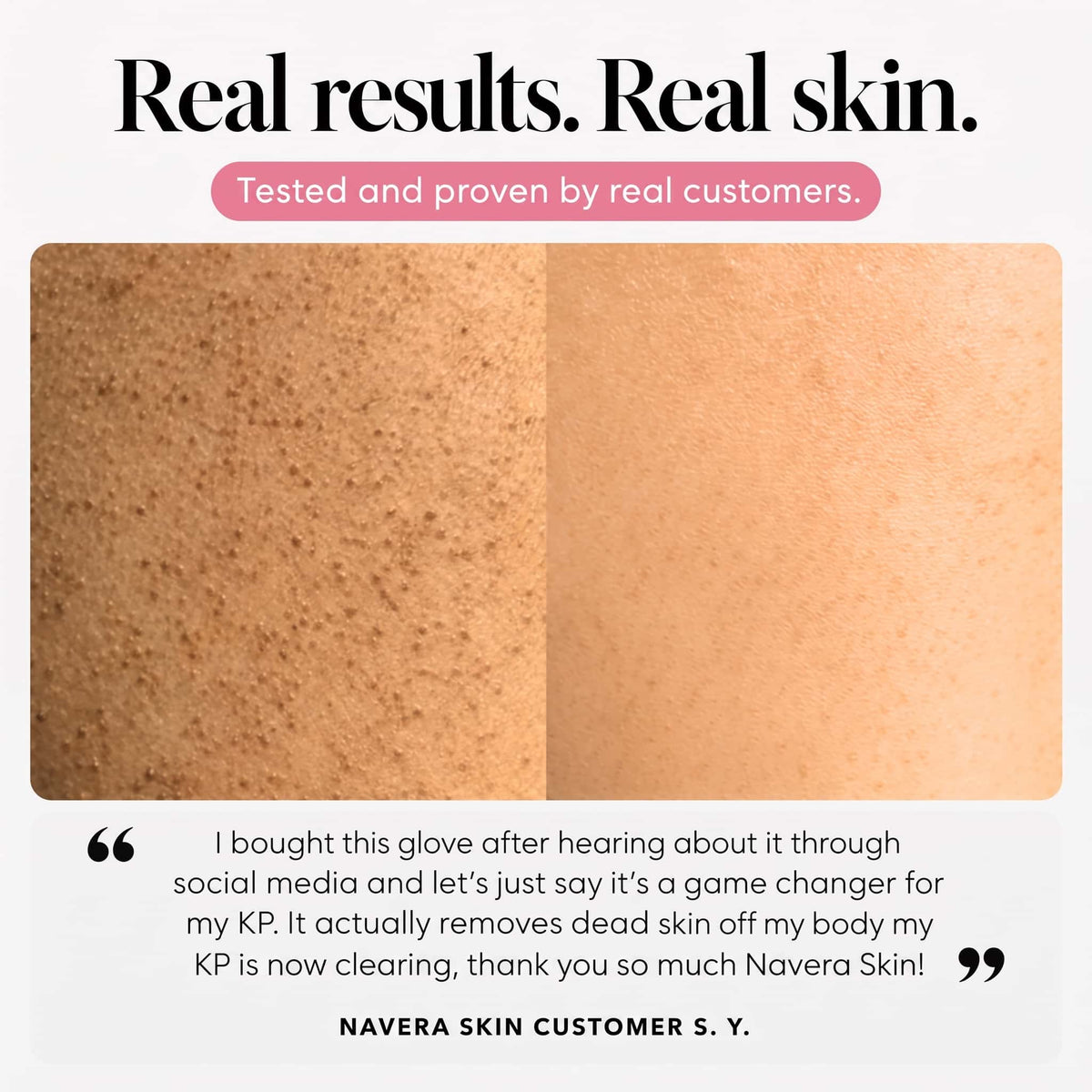 Navera Exfoliating Glove